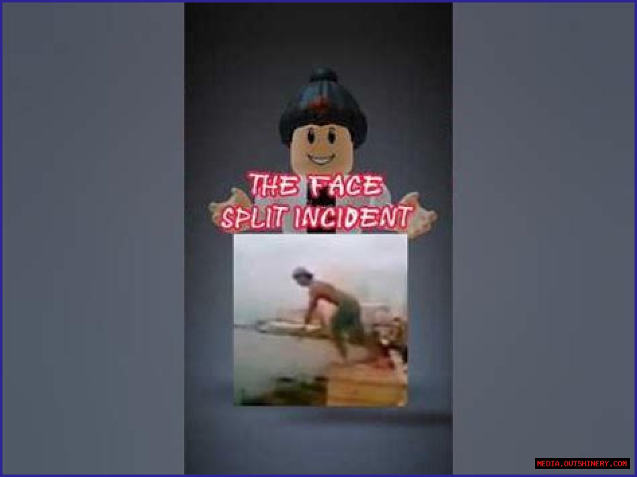 Face Split Incident 2024: The Original Video And Story Behind It