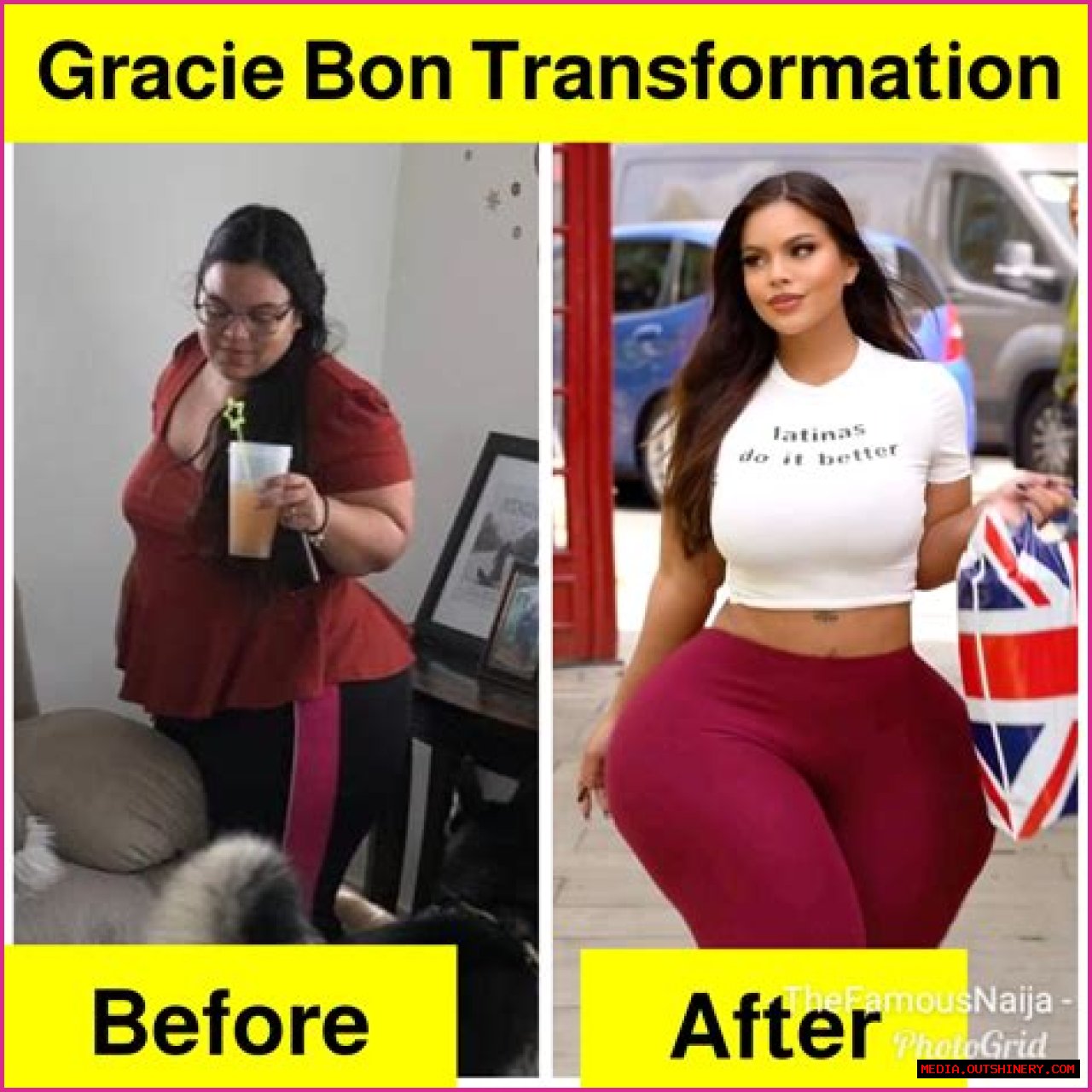 Gracie Bon's Journey: A Glimpse Before Surgery