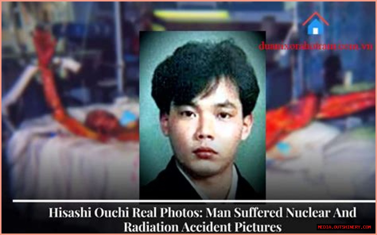 Hisashi Ouchi: The Real Photos And Tragic Story