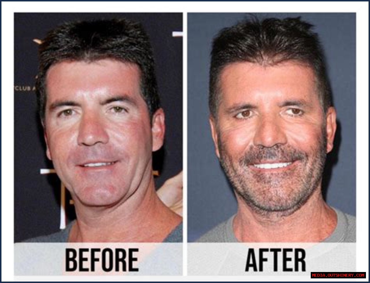 What Is Wrong With Simon Cowell's Son? Understanding The Challenges And Triumphs